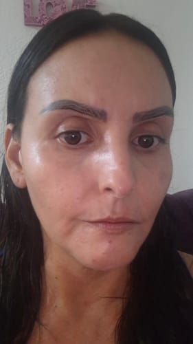 Customer photo review of Seyoul™ Suero 21 Días - T01