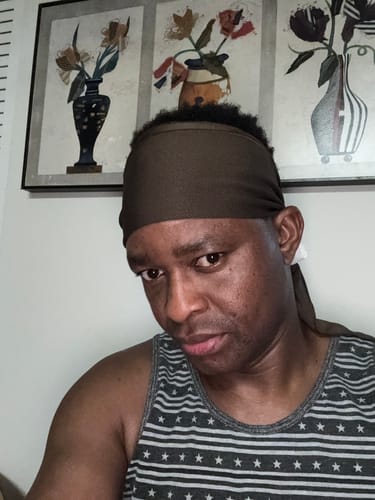 Customer photo review of Rennora Hair Growth Serum