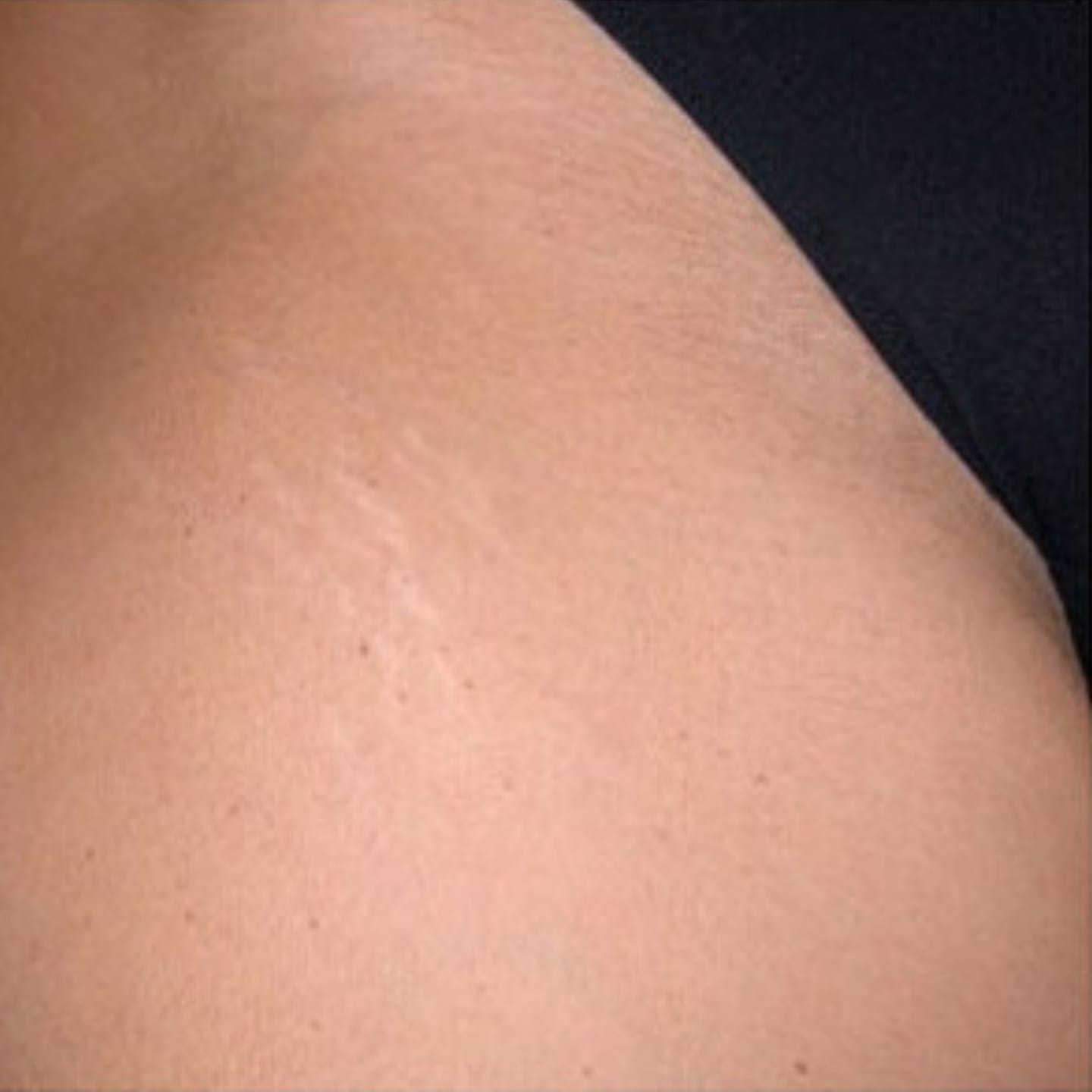 Customer photo review of SilkGlide Pro™
