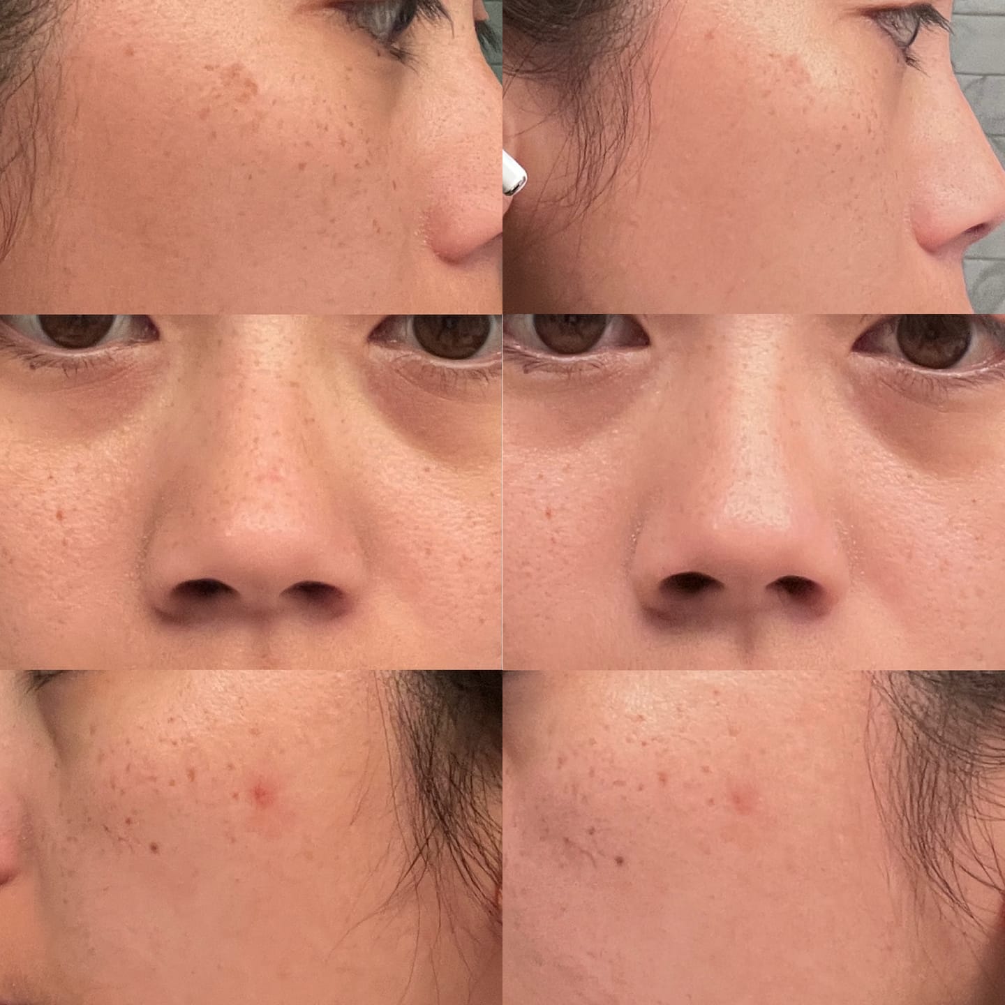 Customer photo review of The Complete System for Mature Women’s Skin
