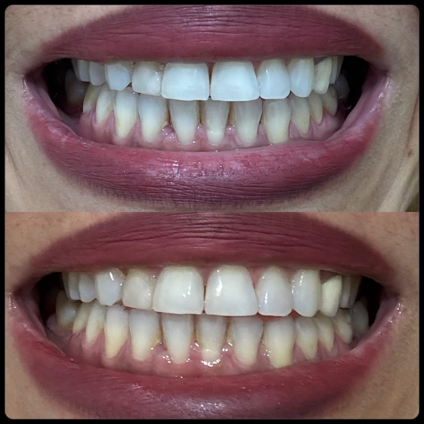 Customer photo review of Serum Abrillantador Boqa®