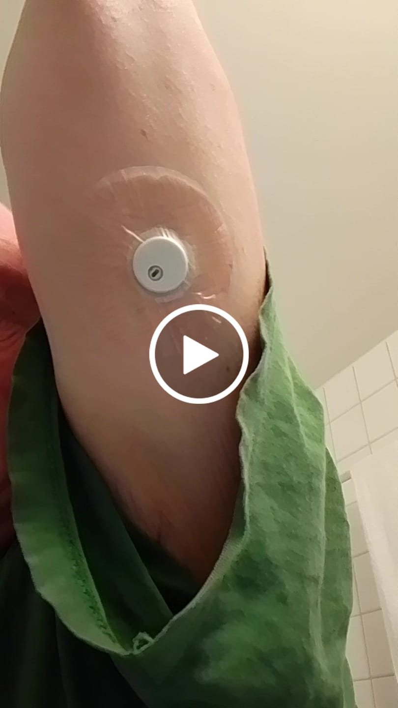 Customer video review of Transparent CGM Patch för Freestyle Libre 1, 2 & 3