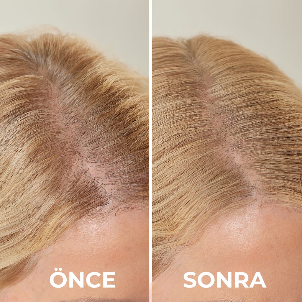 Customer photo review of Flxhair Saç tozu