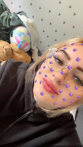 Customer photo review of COSTIQ® EXTREME LIP PLUMPER