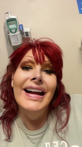 Customer photo review of Imako® Cosmetic Teeth Kit
