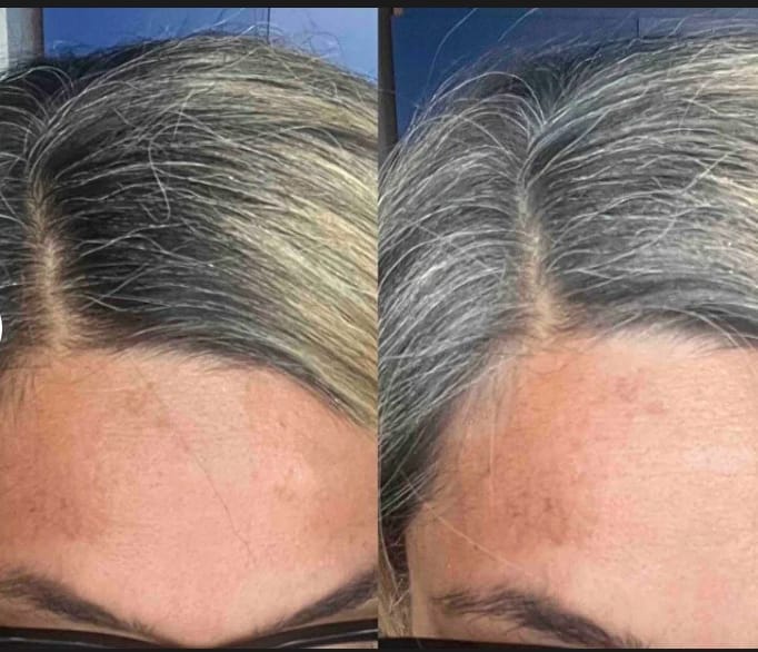 Customer photo review of Flxhair Saç tozu