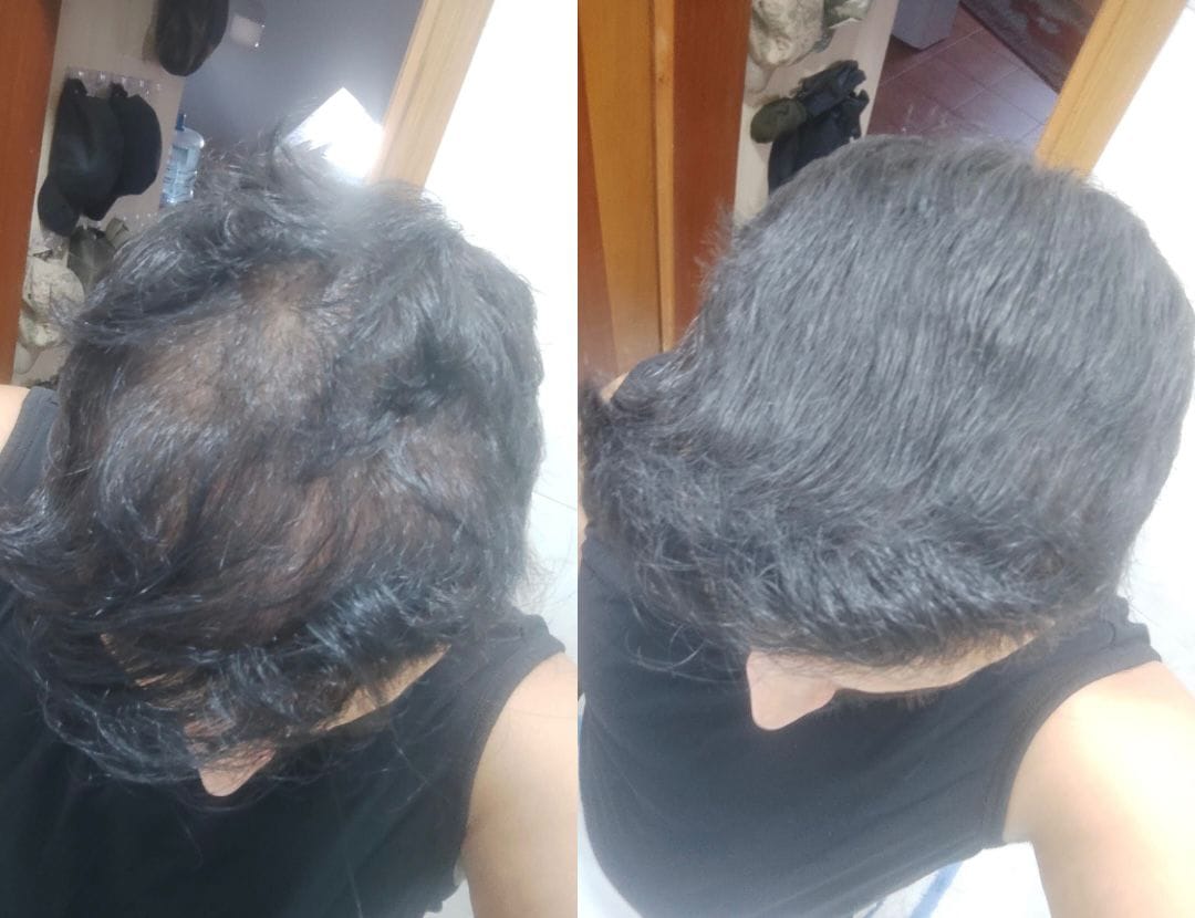 Customer photo review of Flxhair Saç tozu