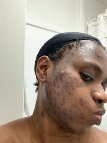 Customer photo review of Turmeric Glow Soap