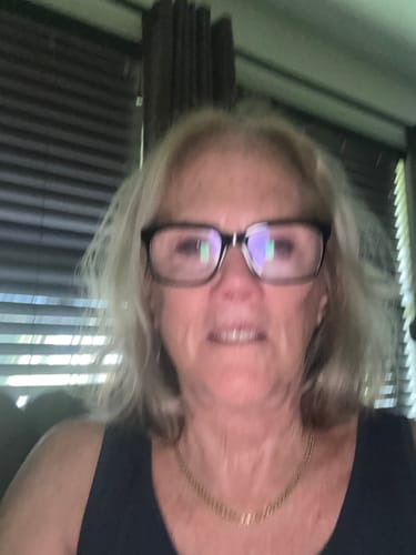 Customer photo review of Neptune Grass Fed Tallow & Honey Balm