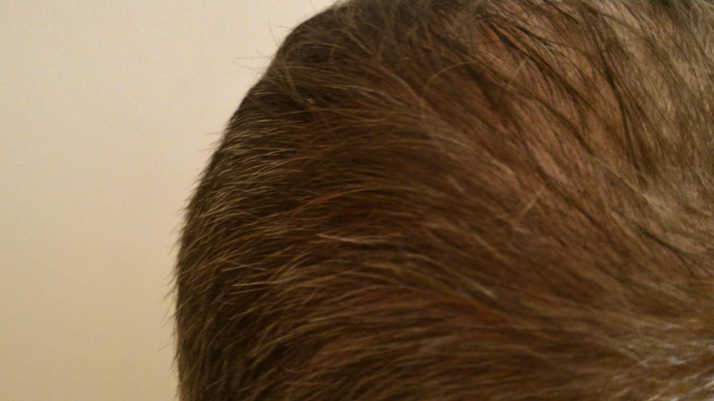 Customer photo review of GR-7 PRO