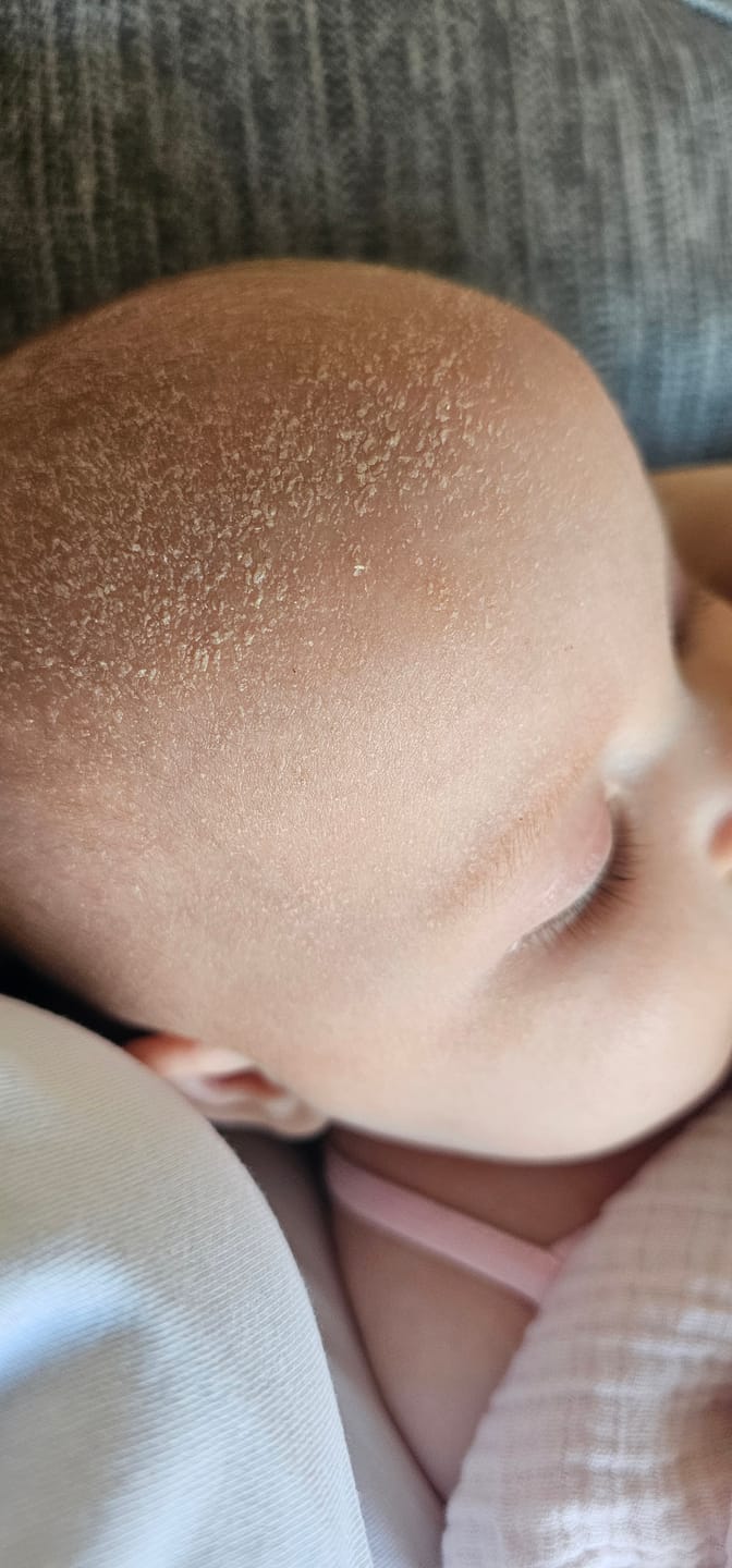 Customer photo review of Bioskin Junior Duo Pack