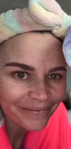 Customer photo review of Dewy Skin Bundle