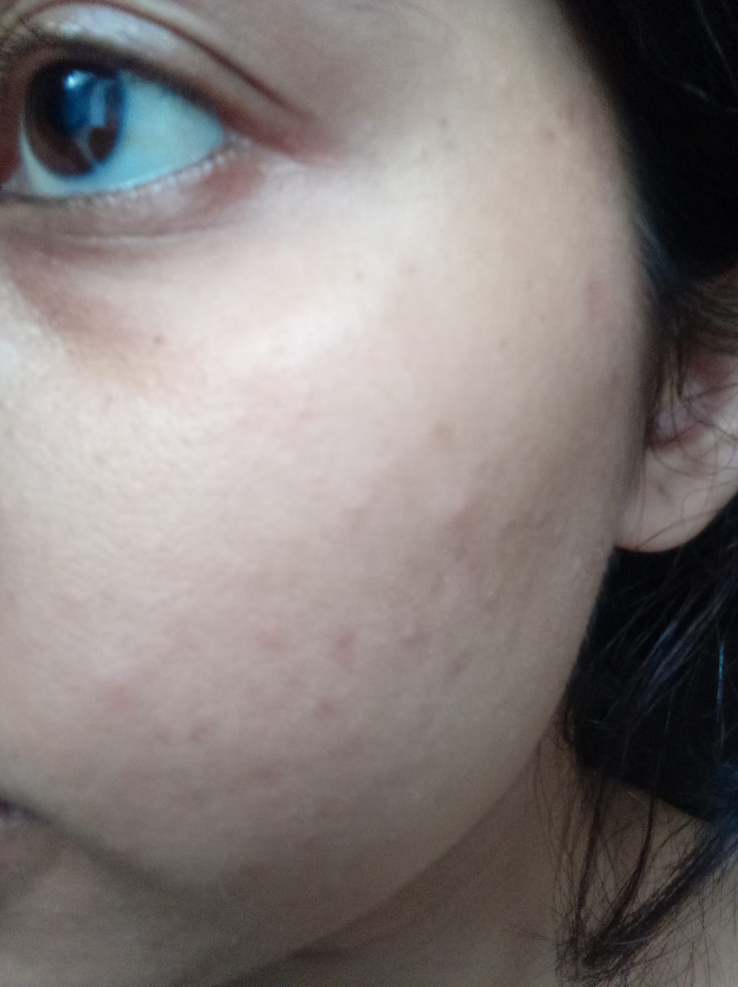 Customer photo review of DREAM CREAM - Instant Skin Reviver
