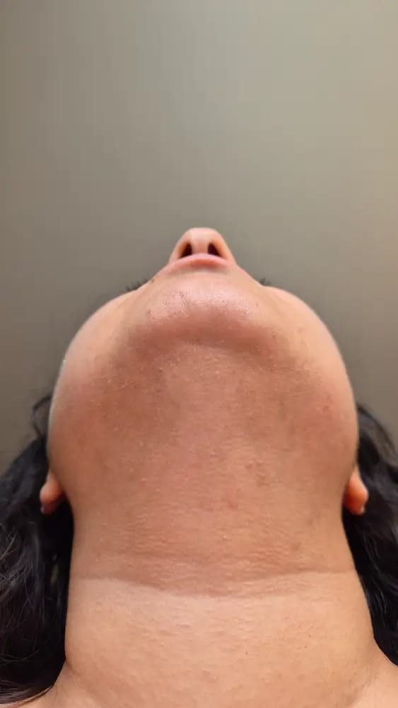 Customer photo review of SkinUp Pro
