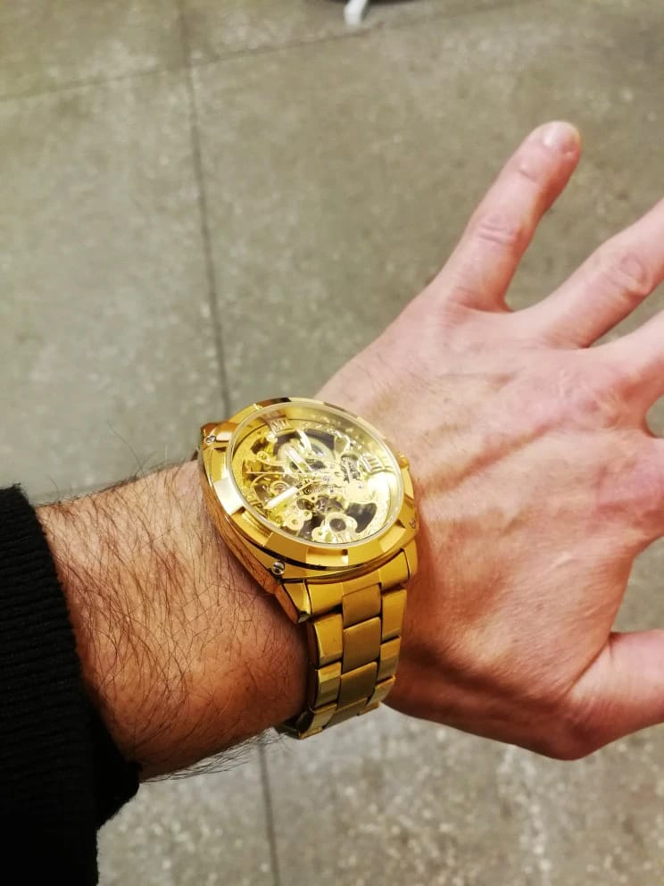 Customer photo review of STERLINGX - Transparent