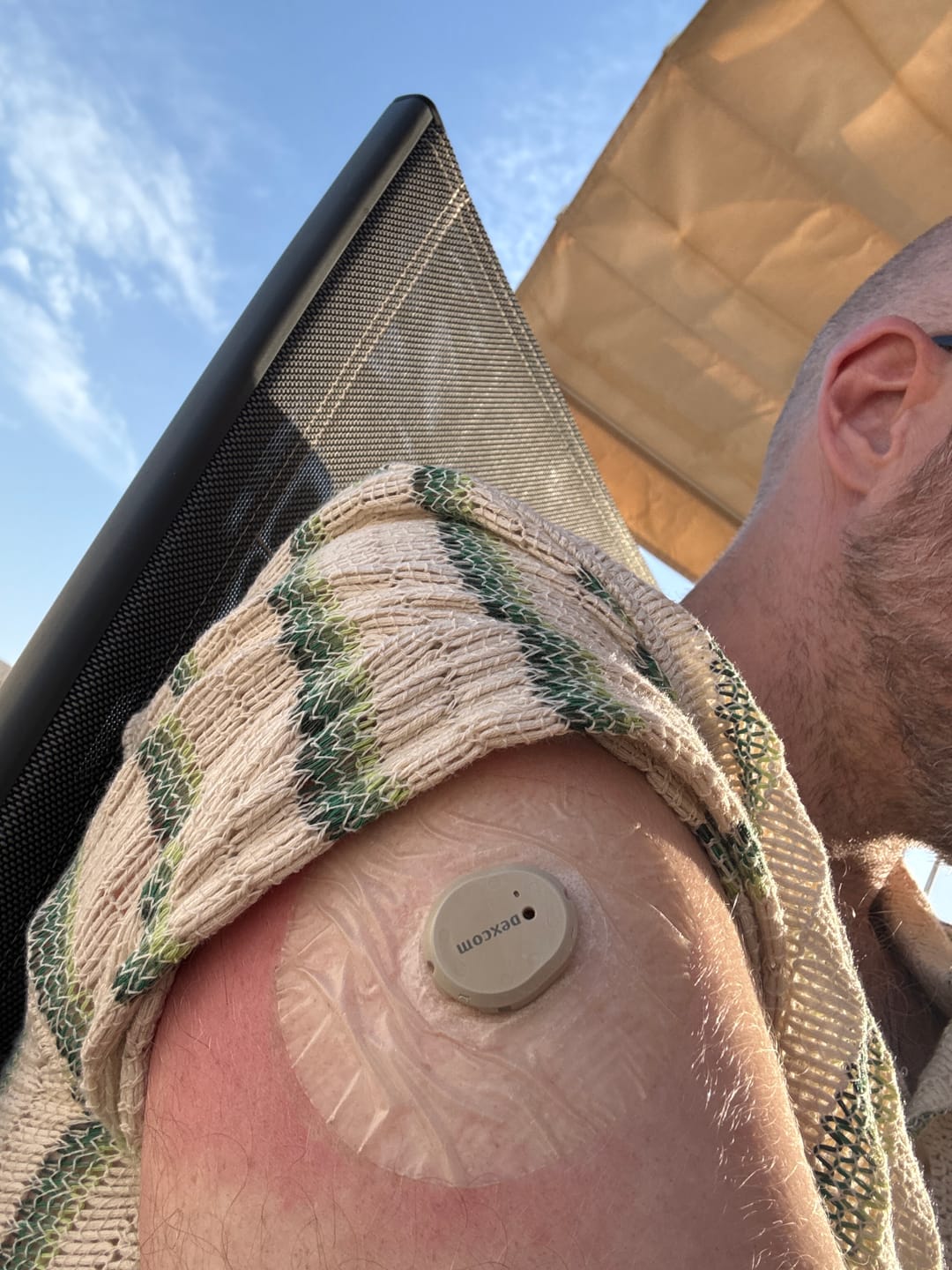 Customer photo review of StayActive Sport CGM-Sensor overpatches Aktiv Transparent för Dexcom G7
