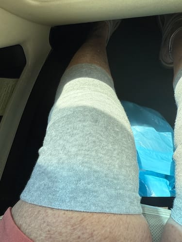 Customer photo review of Premium Bamboo Knee Sleeve (Single)