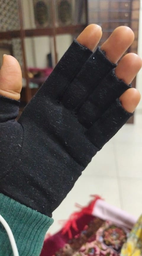 Customer photo review of Therapeutic Heat Gloves