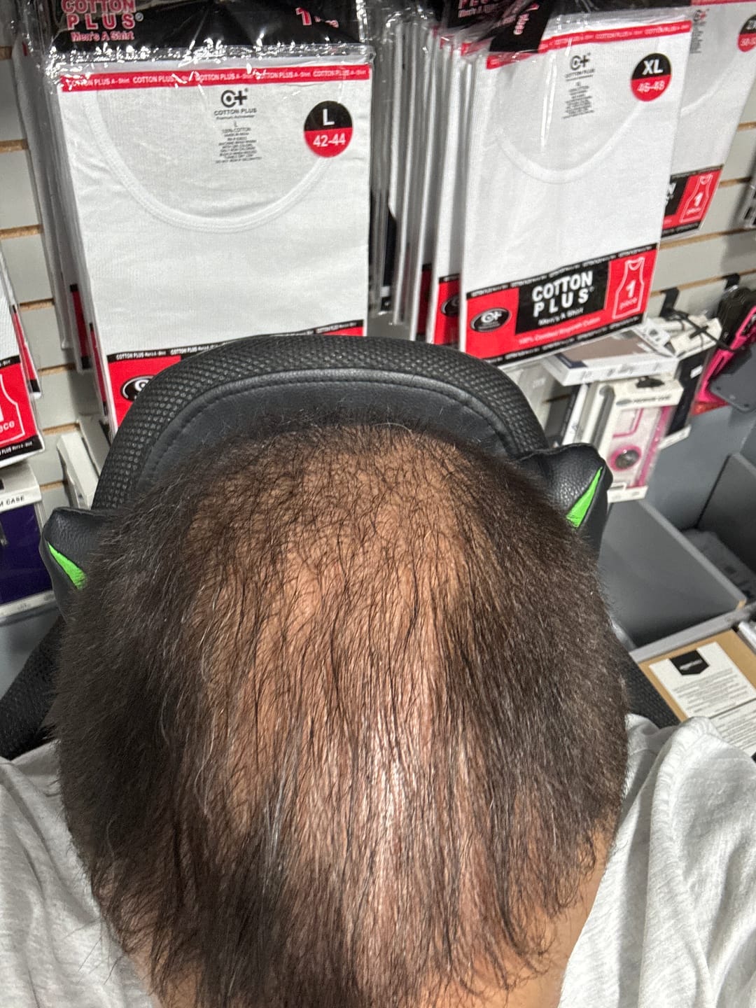 Customer photo review of Hair Loss Prevention Kit