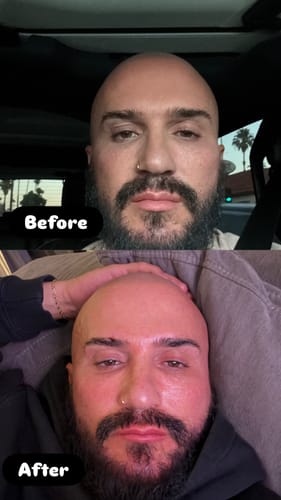 Customer photo review of Neptune Grass Fed Tallow & Honey Balm