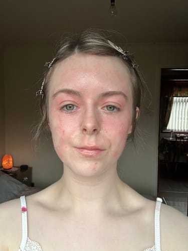 Customer photo review of Calm Balm