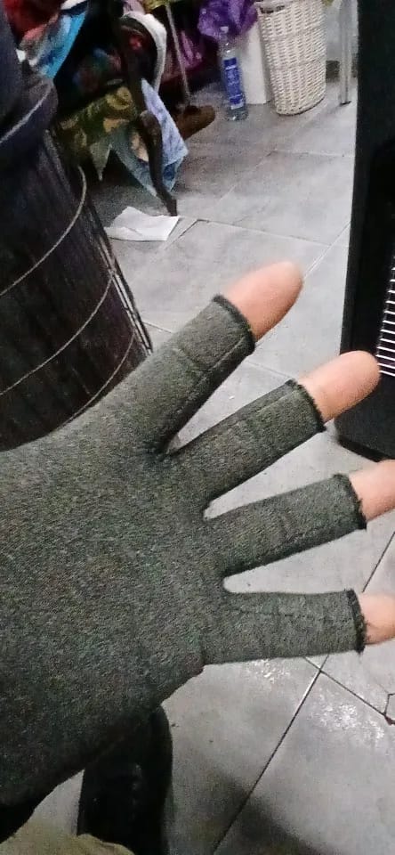 Customer photo review of Therapeutic Heat Gloves