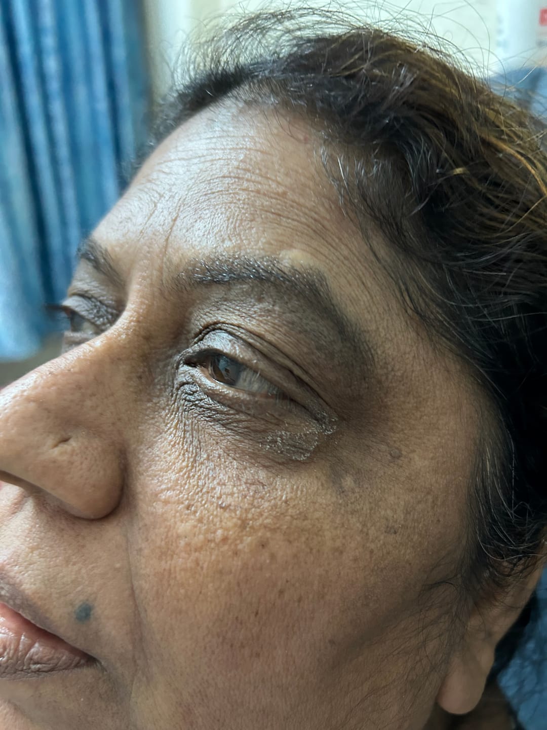 Customer photo review of Turmeric Night Repair Cream