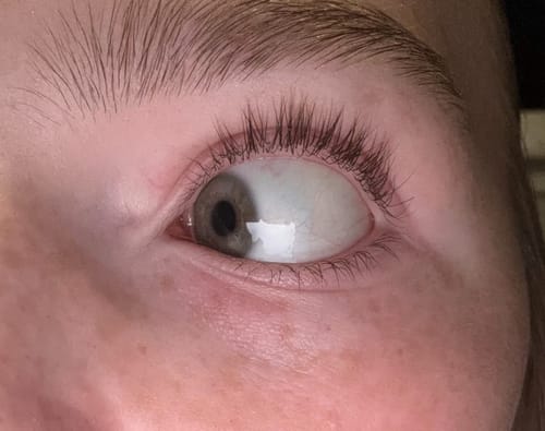 Customer photo review of Lash Growth Serum