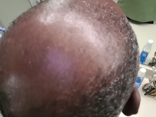 Customer photo review of Rennora Hair Growth Serum