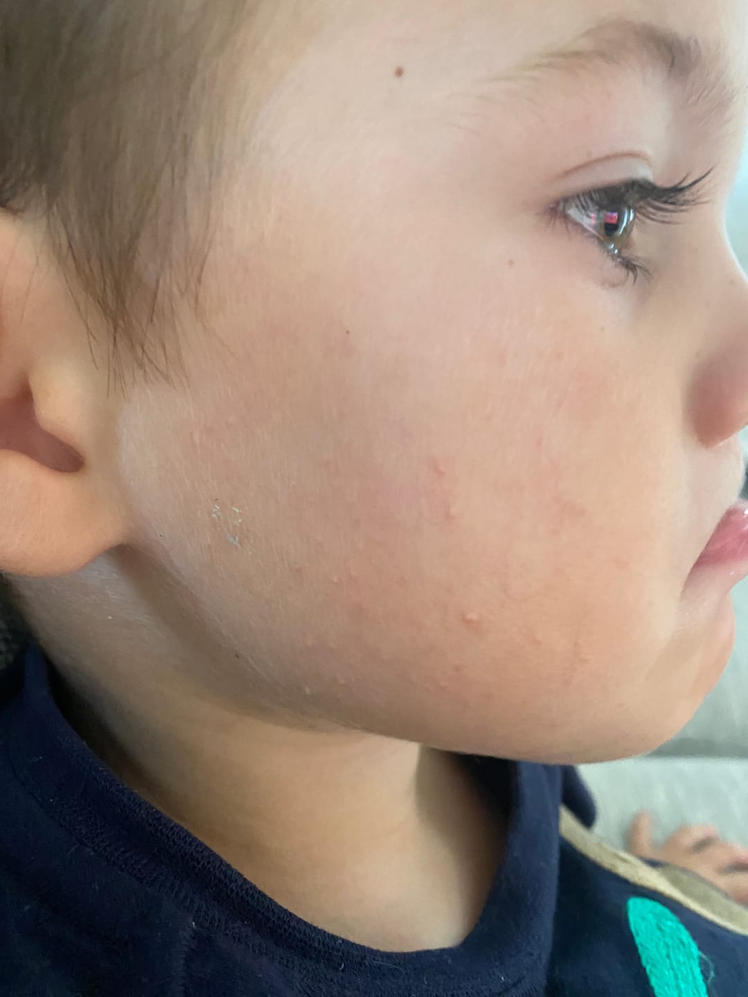 Customer photo review of Children’s Gut Rebalance Kit