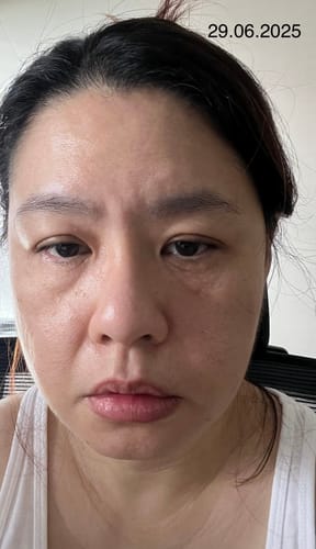 Customer photo review of OUTGLOW - Radiance Tri-Factor™ Jelly