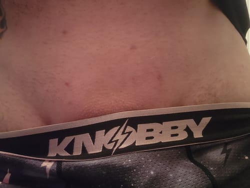 Customer photo review of ILUUMI PRO