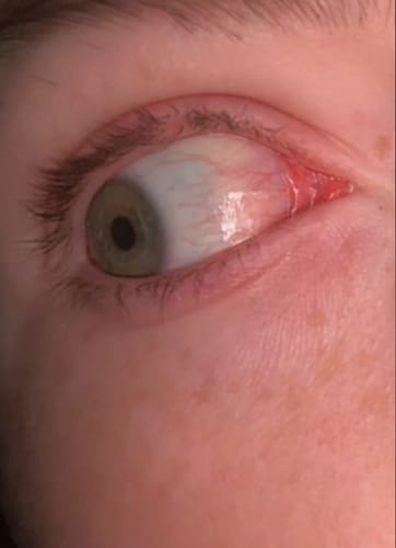 Customer photo review of Lash Growth Serum