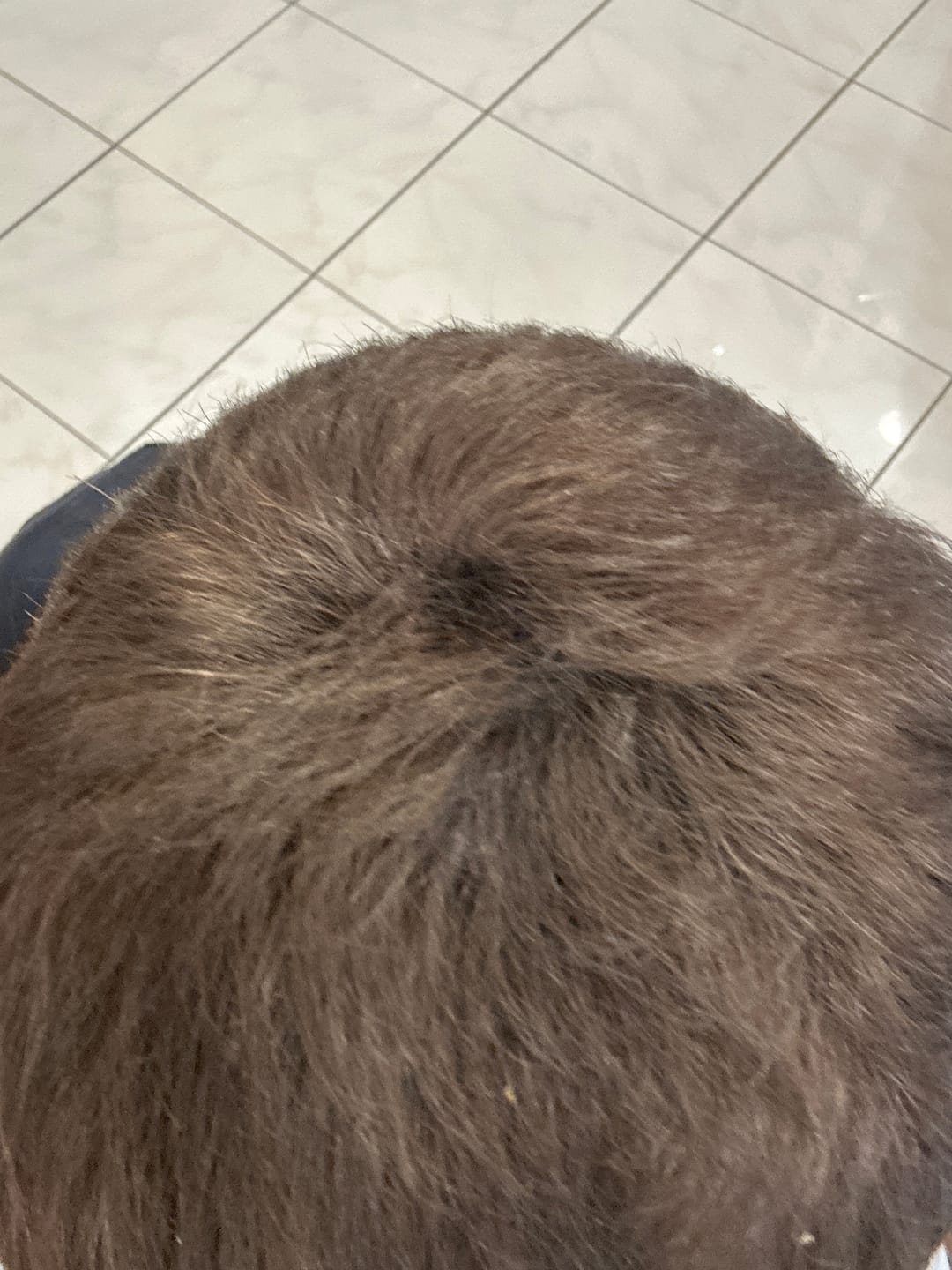 Customer photo review of Fibre copri Calvizie da 12gr  | Castano Scuro | 30 Giorni di applicazioni