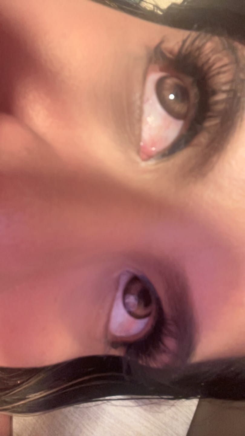 Customer photo review of Aine NutCracker Brown Prescription Colored Contact Lenses