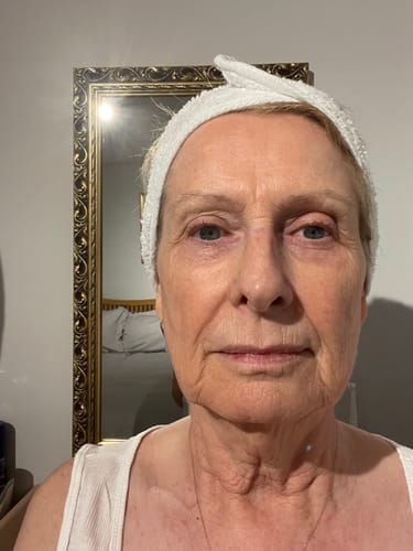 Customer photo review of SEA BUCKTHORN SERUM (100ml)