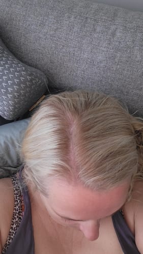 Customer photo review of Sunkissed Refill 1-pack