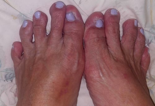 Customer photo review of P733 Ballad Purple Crème Nail Polish