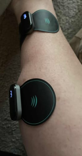 Customer photo review of Vibit TENS - Electrical Nerve Stimulation Therapy