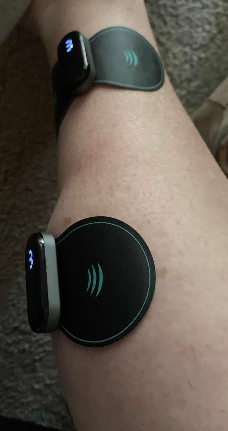 Customer photo review of Vibit TENS - Wireless Electrical Muscle Stimulator