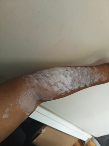 Customer photo review of Turmeric Glow Soap