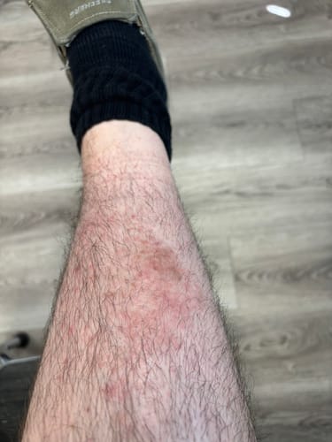 Customer photo review of F-Balm - Anti-Aging Tallow Balm - Black Label (UNSCENTED) - 2 oz.