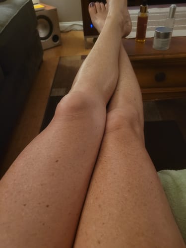 Customer photo review of Besque™ Magic Body Oil - 100ml