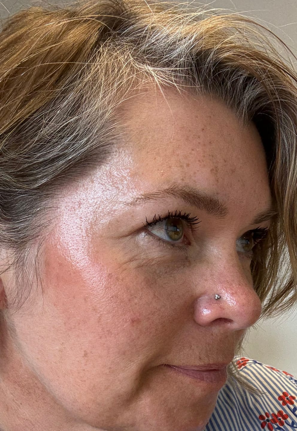 Customer photo review of Junipurr Titanium Flatback Labret Threadless