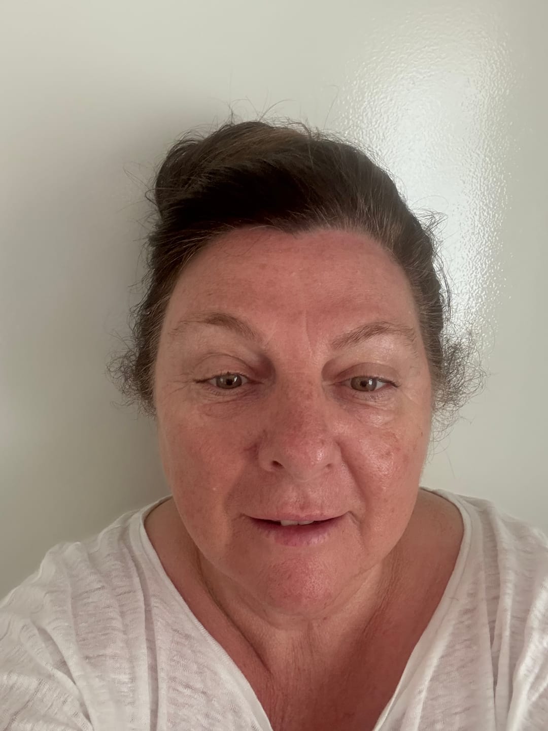 Customer photo review of The Wrinkle Defense Kit