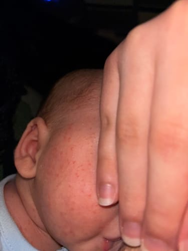 Customer photo review of All Over Ointment Original