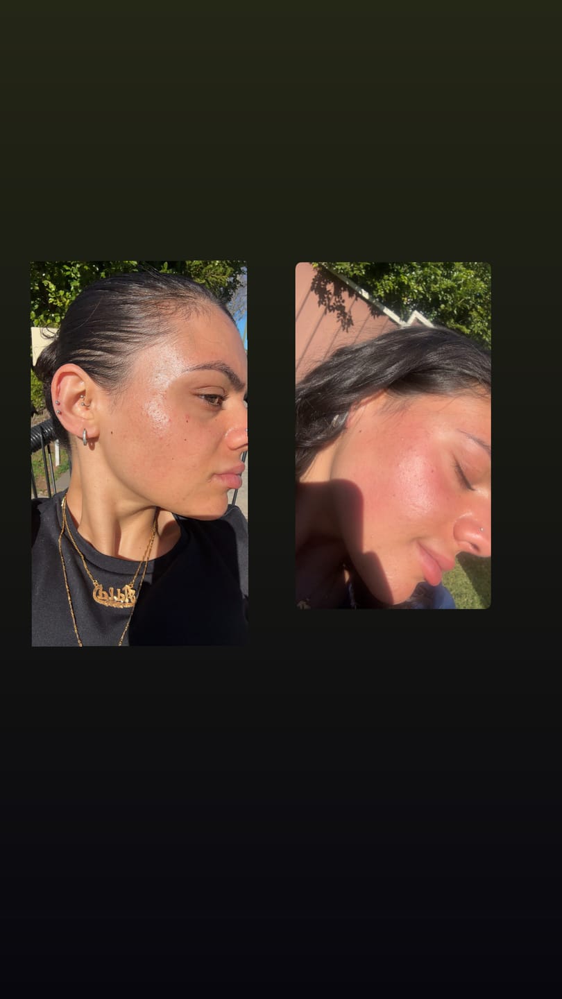 Customer photo review of ⭐ Full Set