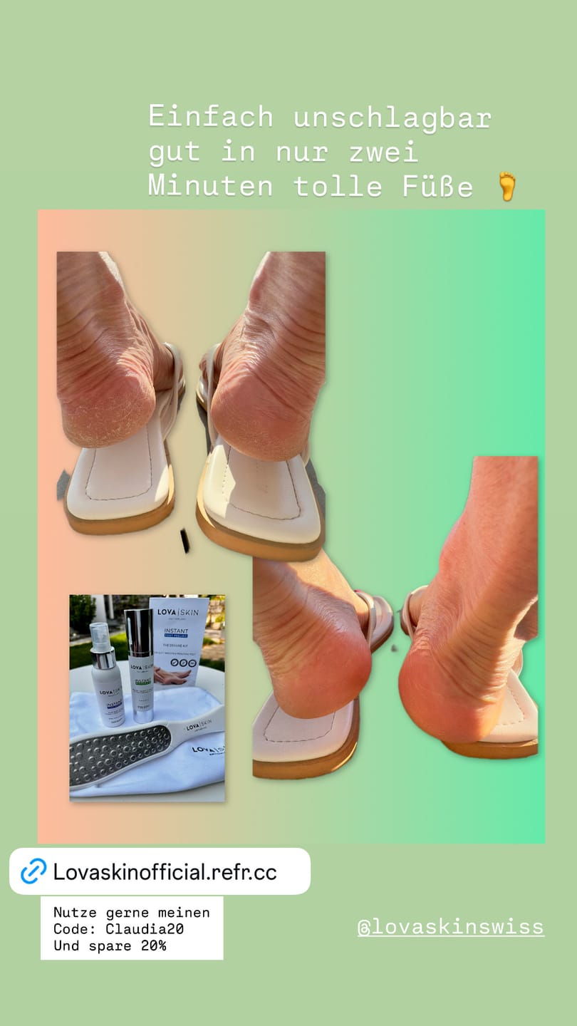 Customer photo review of LOVASKIN INSTANT FOOT PEEL Travel Bottle - Over 8 Beauty pedicure treatments