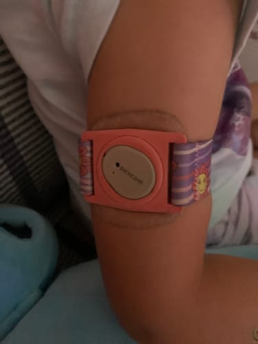 Customer photo review of Dexcom G7 sensor Armband for children with rotating clip - Dia-Style Kiddy