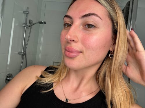 Customer photo review of Serum Triple Pack